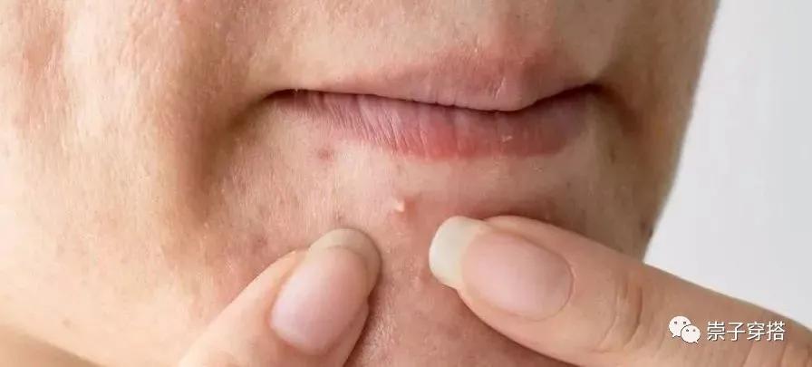 男生脸部护肤的正确步骤,男生护肤需要哪几样