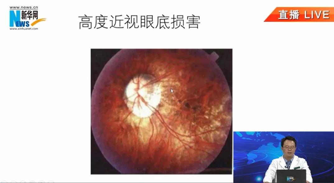 小孩假近视家长怎么办,孩子近视家长怎么调整心态