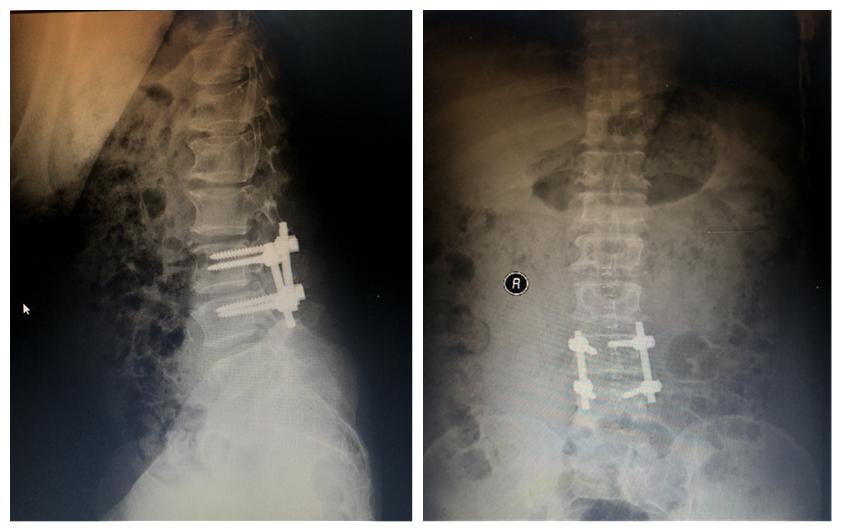 医播报,病例讲解