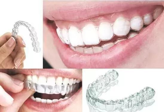 helen齿科,隐形牙套正畸刷牙正确方法