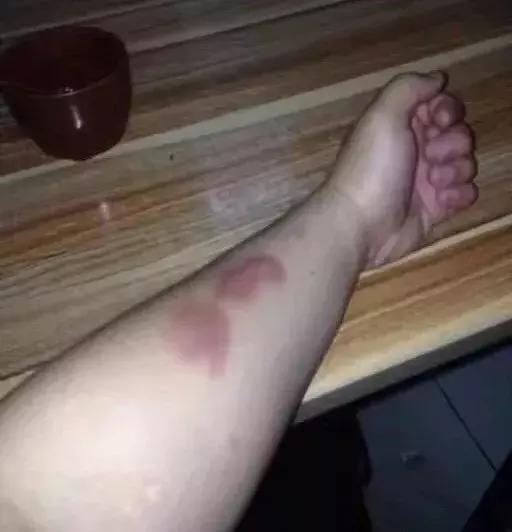 咏春拳摊膀伏教学,咏春拳摊膀伏厉害吗