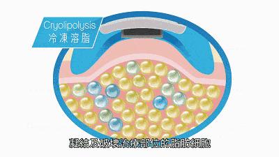 医美市场整形项目分析,医美市场规模估算方法