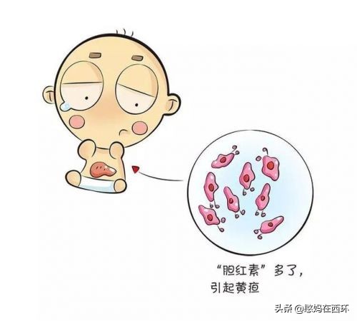 新生儿生理性黄疸病理性黄疸区别,新生儿黄疸与病理性黄疸怎样鉴别