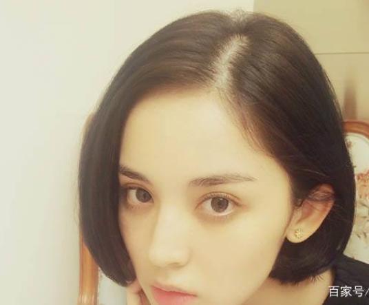 怎么判定自己的发际线高不高,天生发际线高m型发际线