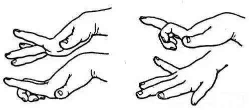 gms诊断脑瘫的标准是什么,全身运动gms评估有多少种结果