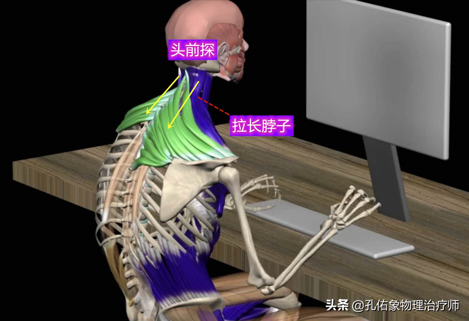 为什么颈部痛,颈肩部疼痛的康复治疗