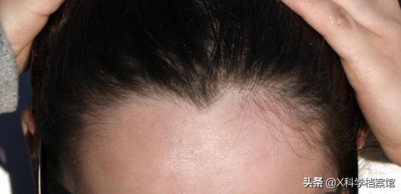 让你大开眼界的生物视频,大开眼界的新物种