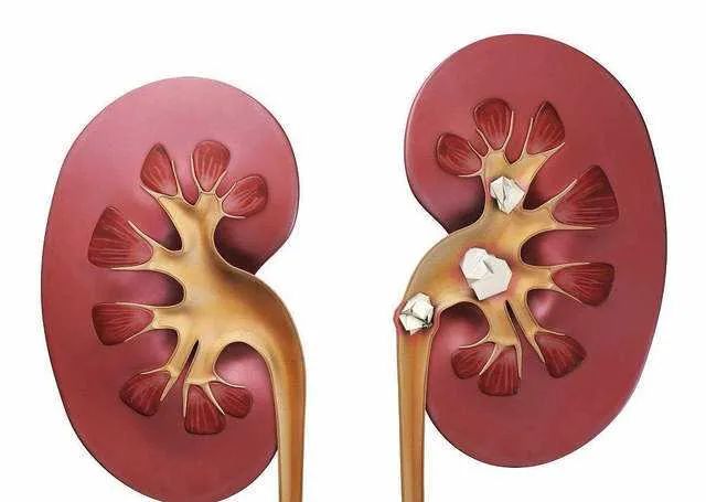 输尿管电子软镜,江苏一次性输尿管软镜