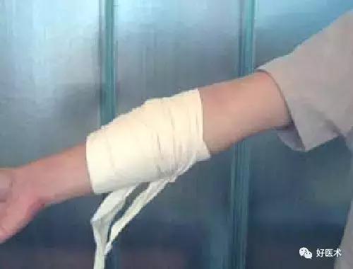 骨科急救处理流程图,骨科急救原则及注意事项