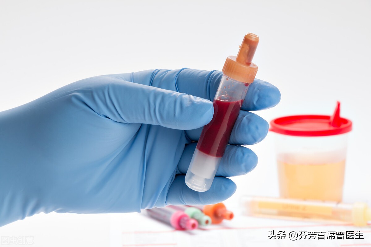 膀胱癌患者大部分存活不过20年,一个已存活15年的晚期膀胱癌患者