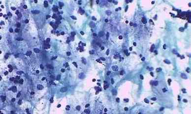 妇科疾病有什么征兆,妇科疾病的10个征兆