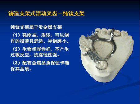 假牙最便宜一颗多少钱,假牙最贵