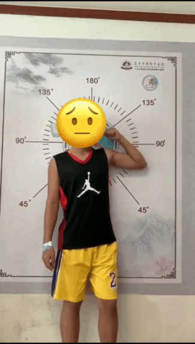 创伤导致肘关节僵硬怎样才能康复,肘关节僵硬康复训练正确方法