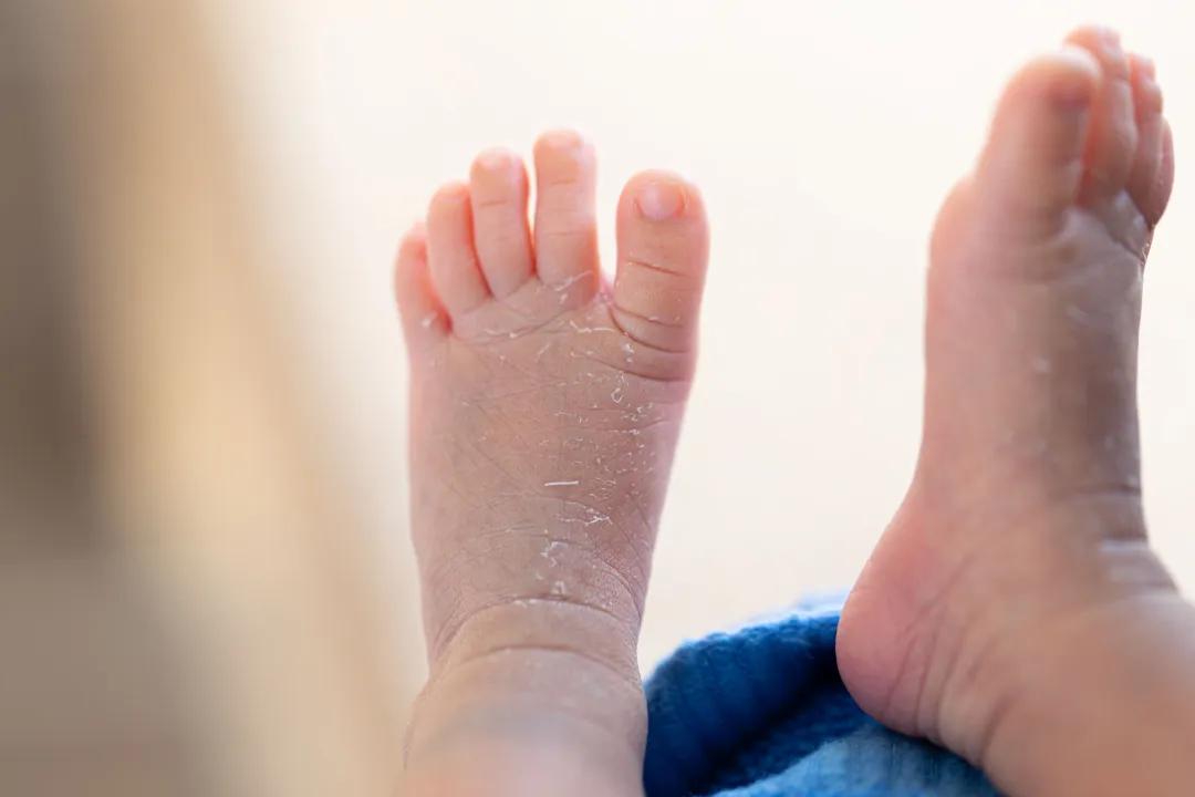 冬季护肤品怎么选？华西专家劝你先搞清楚这3点