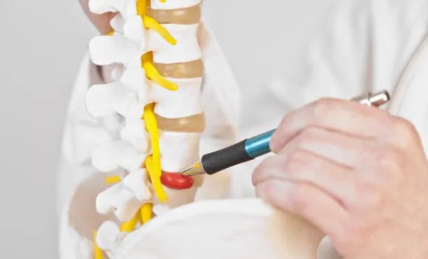 椎孔镜技术治疗颈椎间盘突出,椎间孔镜前沿技术