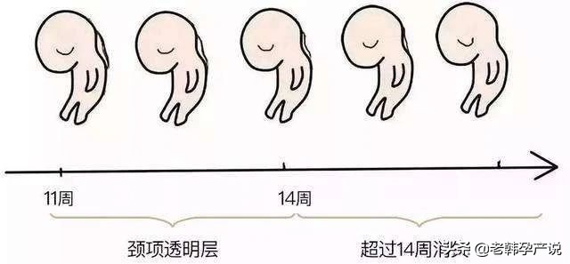 胎儿畸形医院查不出来负责任吗,nt检查出胎儿露脑畸形误诊率高吗