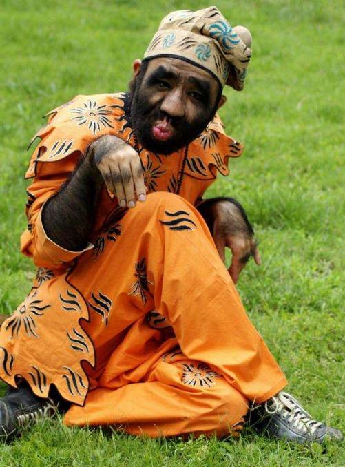 女子浑身长毛发,女子全身长毛发