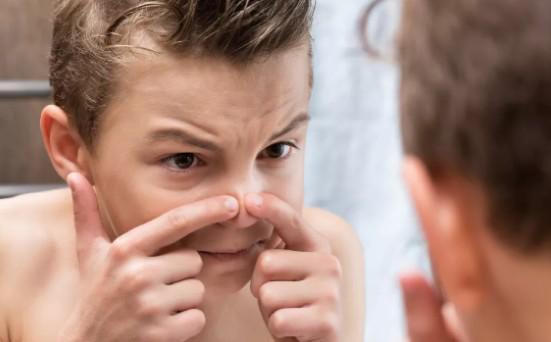 去黑头超快简单粗暴的办法,懒人去黑头小妙招一周去黑头