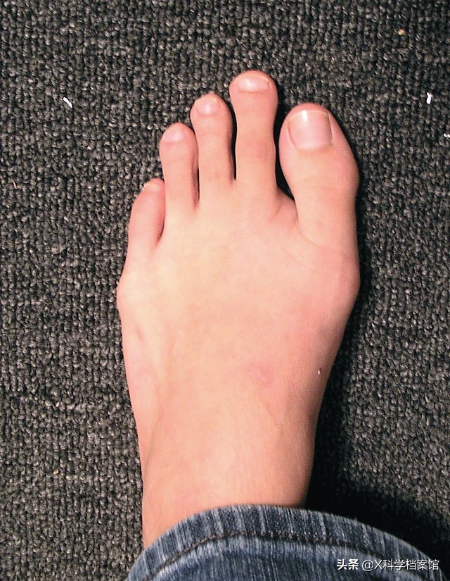 让你大开眼界的生物视频,大开眼界的新物种