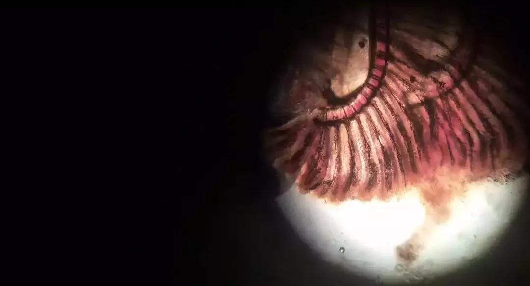 鳃霉和水霉,烂鳃和鳃霉病有何区别