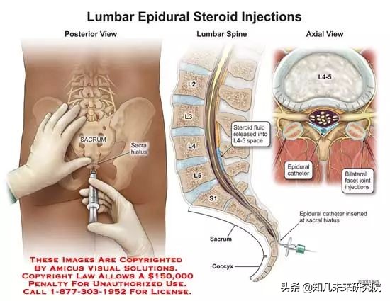 全国第一批无痛分娩试点医院,国内无痛分娩医院名单