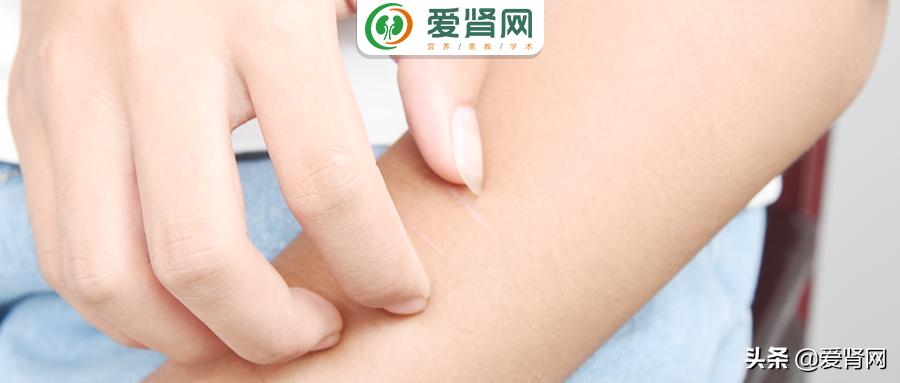 肾友如何应对皮肤瘙痒,肾引起的皮肤痒怎么办