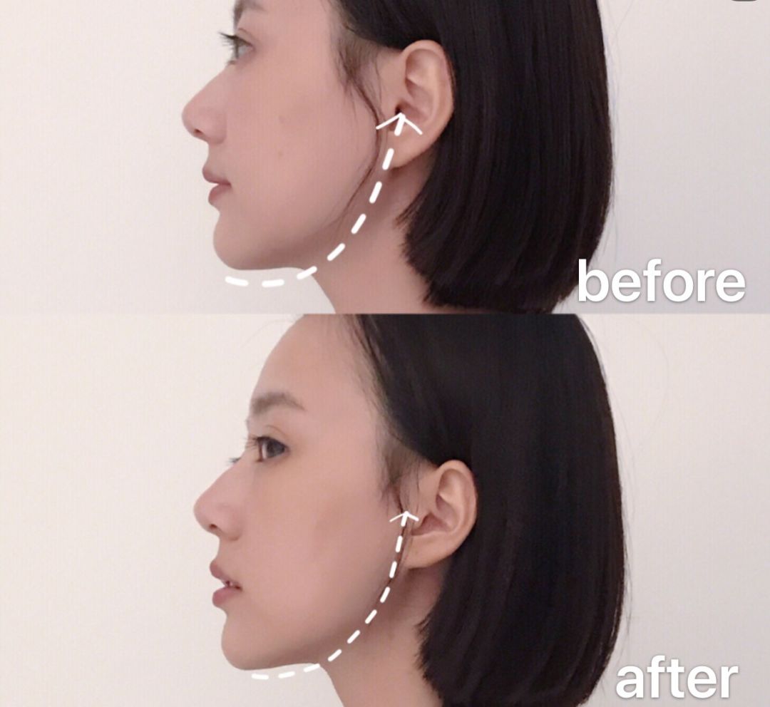 雅萌美容仪2099,雅萌美容仪99和399