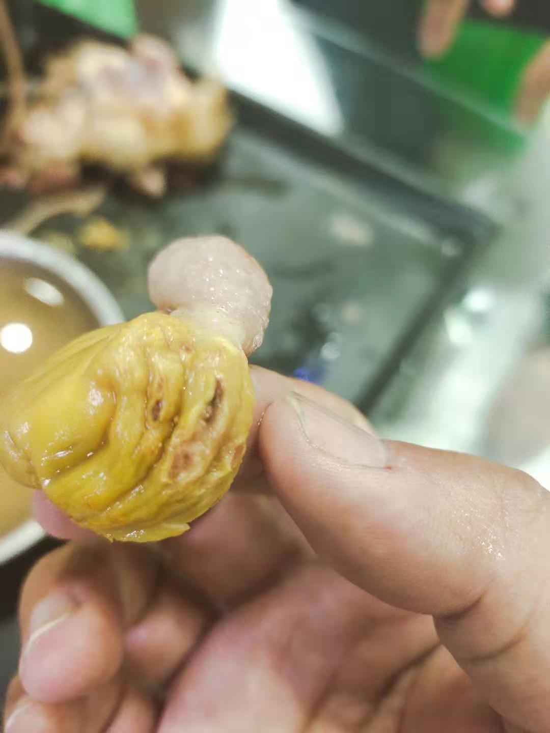 霉菌性炎症治疗经验,霉菌感染怎么治疗医问医答