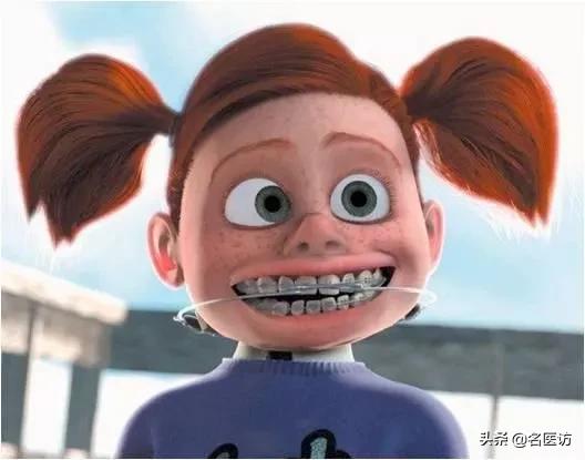 矫正牙齿医生叫打骨钉可以不打吗,正畸打骨钉当天就要挂橡皮筋了吗