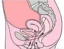 老生常谈那些事儿（二）：“盆底修复”？什么东东？有必要吗？