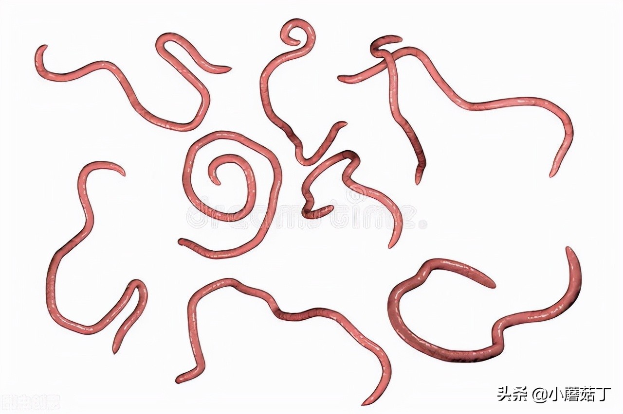 蛲虫病会引起皮肤瘙痒吗,蛲虫导致孩子屁股痒怎么办