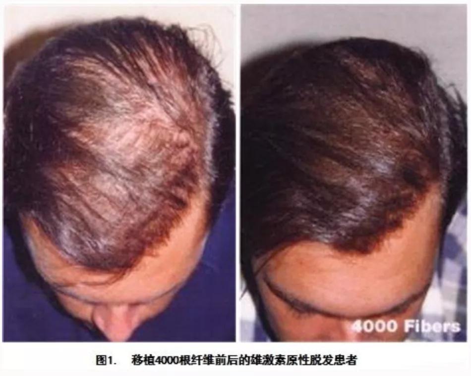 鞠婧祎怎么用发型来掩盖自己脸型,鞠婧祎头发细软塌适不适合