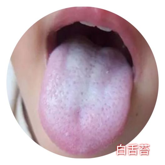 小孩受凉感冒初期中医怎么处理,孩子感冒初期如何快速抑制感冒