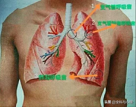 湿啰音干啰音都是什么声音,干啰音和湿啰音什么意思