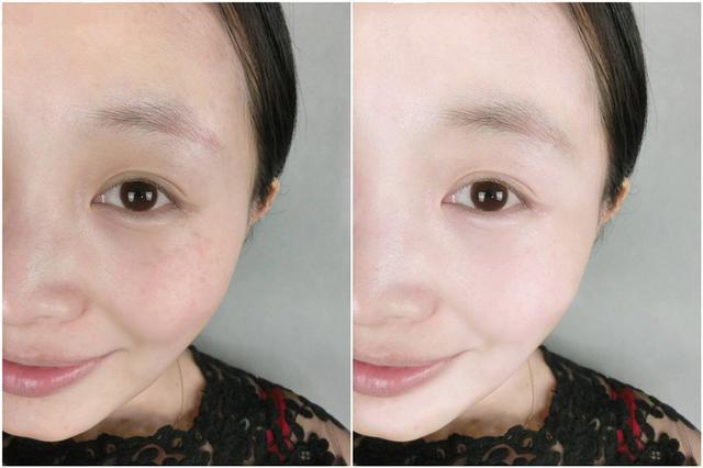 小黑瓶和小绿瓶的精华液哪个好用,小紫瓶精华液第五代和第四代区别