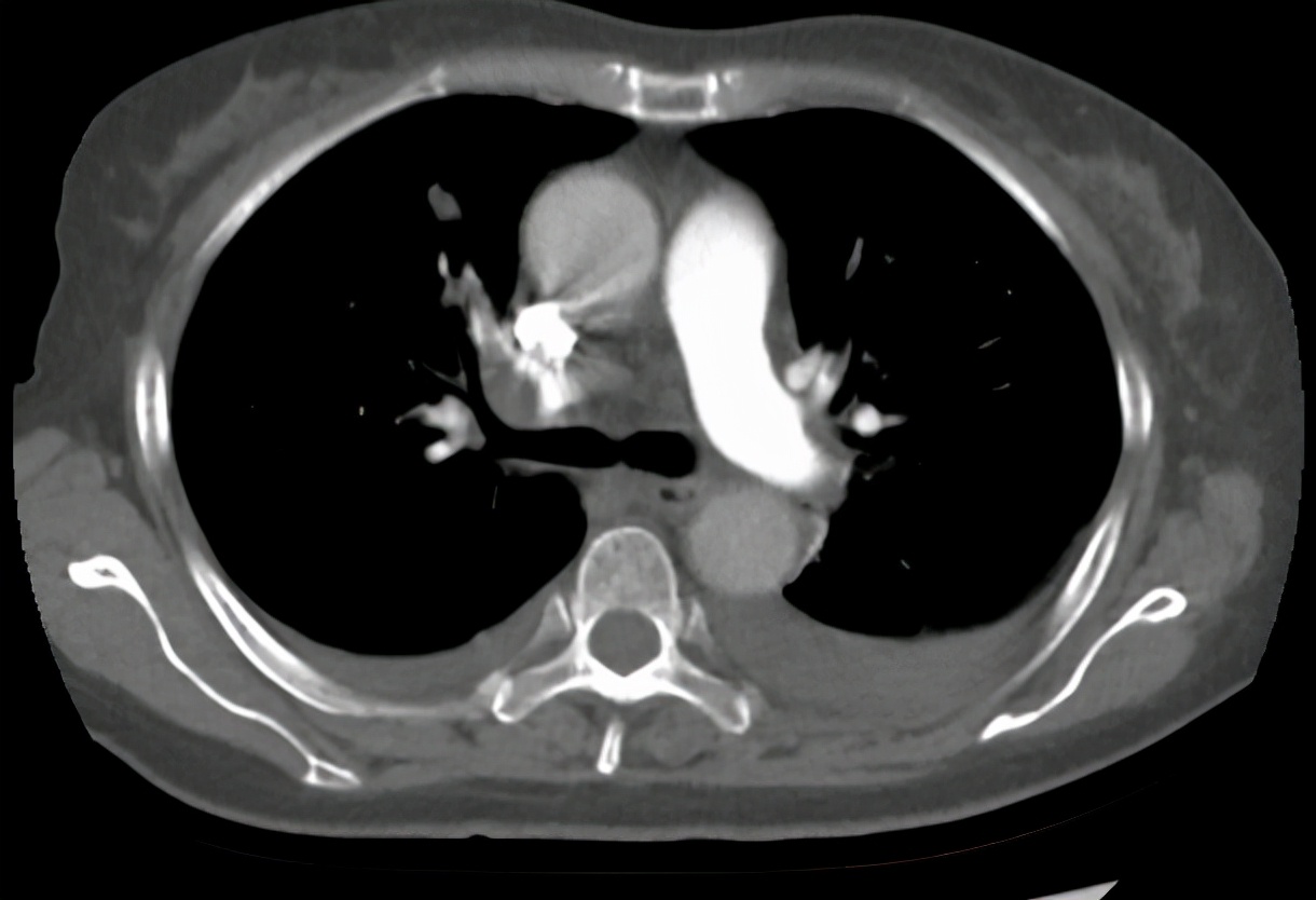 胰腺癌胃痛是什么情况,胃痛和胰腺炎区别与图片