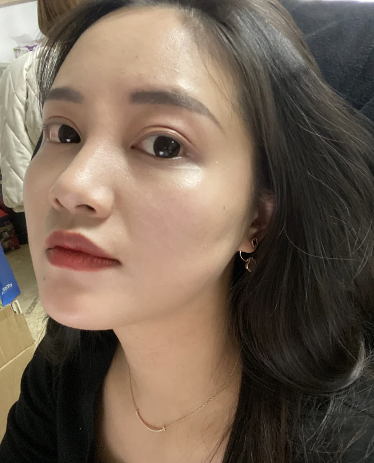 为什么你30岁还长痘？这几个恶习尽快改掉，否则皮肤状态很显老