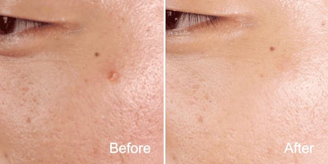 最近流行的面膜是哪个,最近很火的面膜到底怎么样