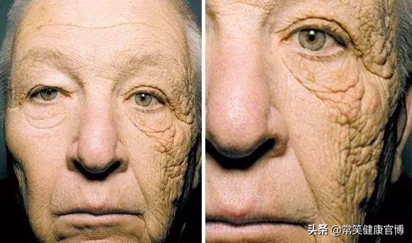 防晒防蚊小技巧,涂防晒可以防蚊子吗