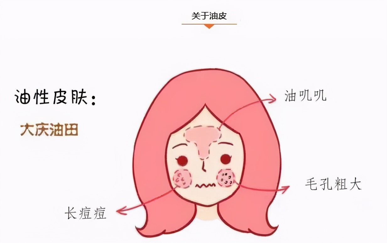 出油毛孔粗大冒痘暗沉怎么改善,男生脸部出油毛孔粗大改善方法