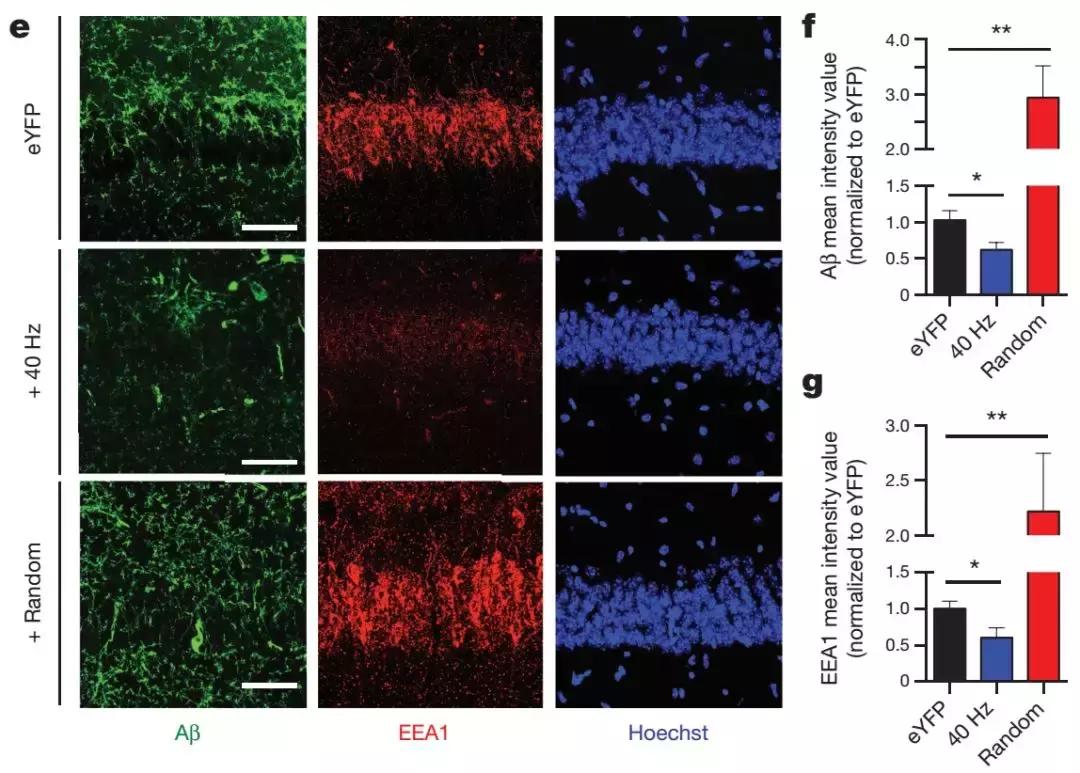 神奇的“光治疗”——药物研发窘境下阿尔兹海默症的治疗探索