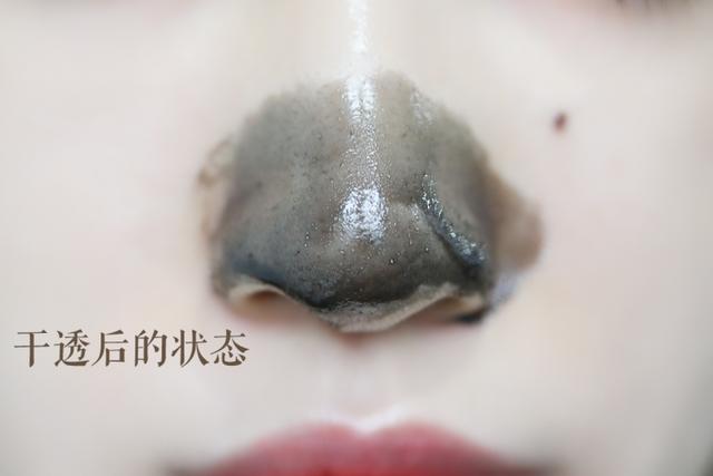 去黑头最好的套装,草莓鼻去黑头套装