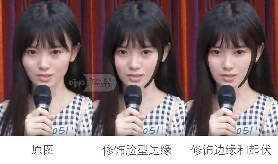 颧弓高脸型怎么改善,有泪沟可以通过调整脸型改善嘛