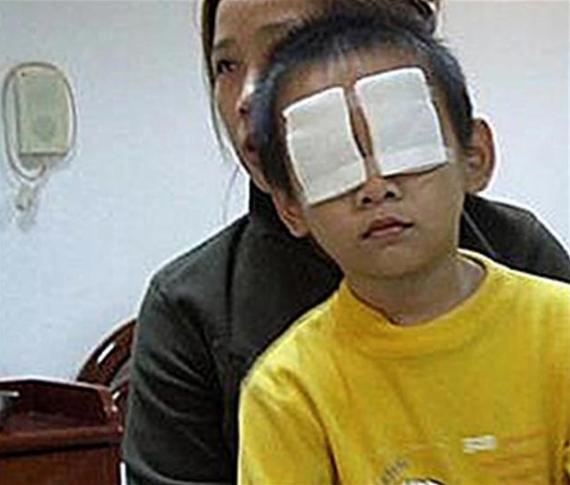 小孩把石灰弄到眼睛里了怎么办,3岁儿童眼睛误入石灰