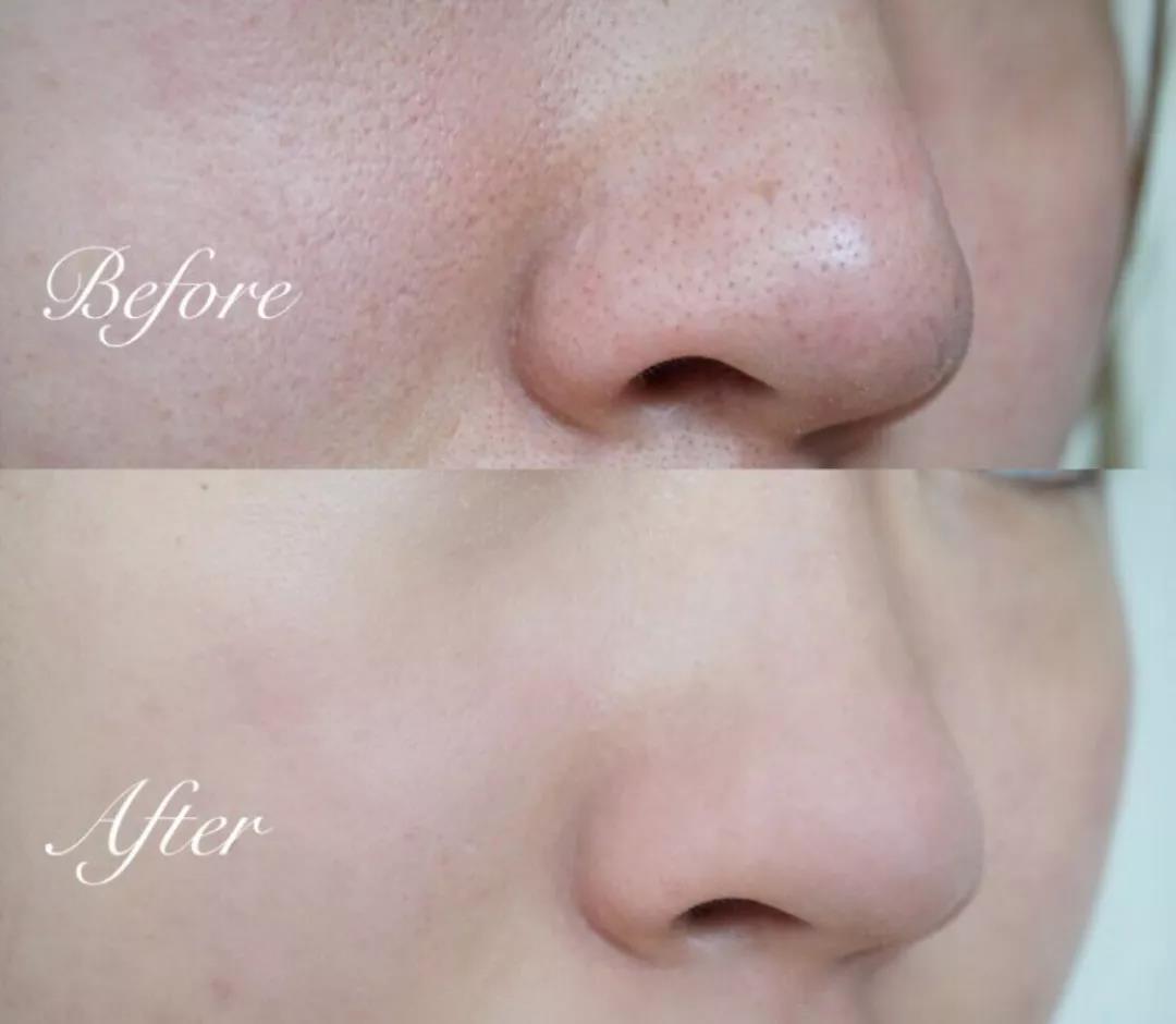 欧莱雅卸妆油和zero卸妆膏,欧莱雅花萃净柔卸妆膏100ml