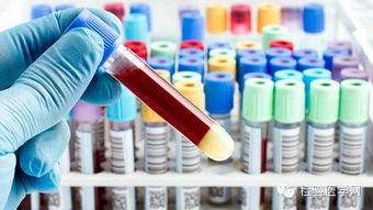 腰僵硬是强直性脊柱炎吗,腰部僵硬是强直性脊柱炎吗