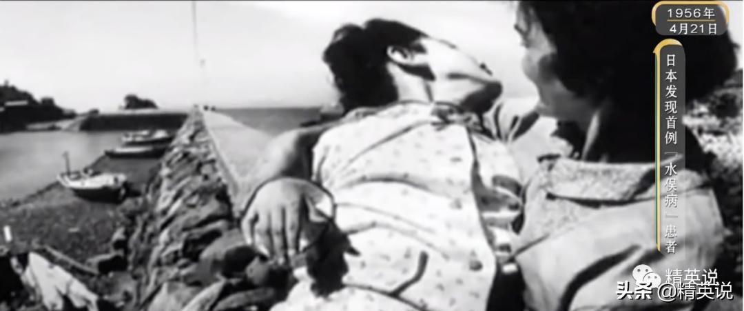60多年前日本万人中毒成世界公害！如今福岛百万吨核废水入海…