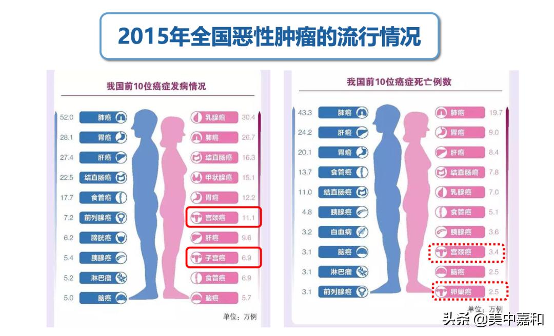 妇科恶性肿瘤的放疗指南,肿瘤医生带你揭秘精准放疗