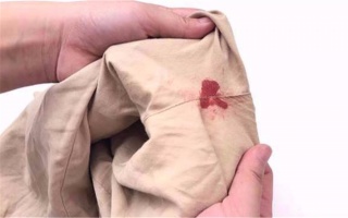 衣服有血渍怎样有效去血渍,血渍在衣服上干了怎么洗才能干净