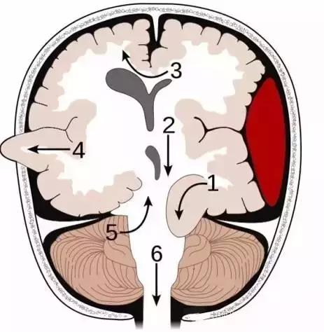面神经分布图片大全,怎么记住面神经分布